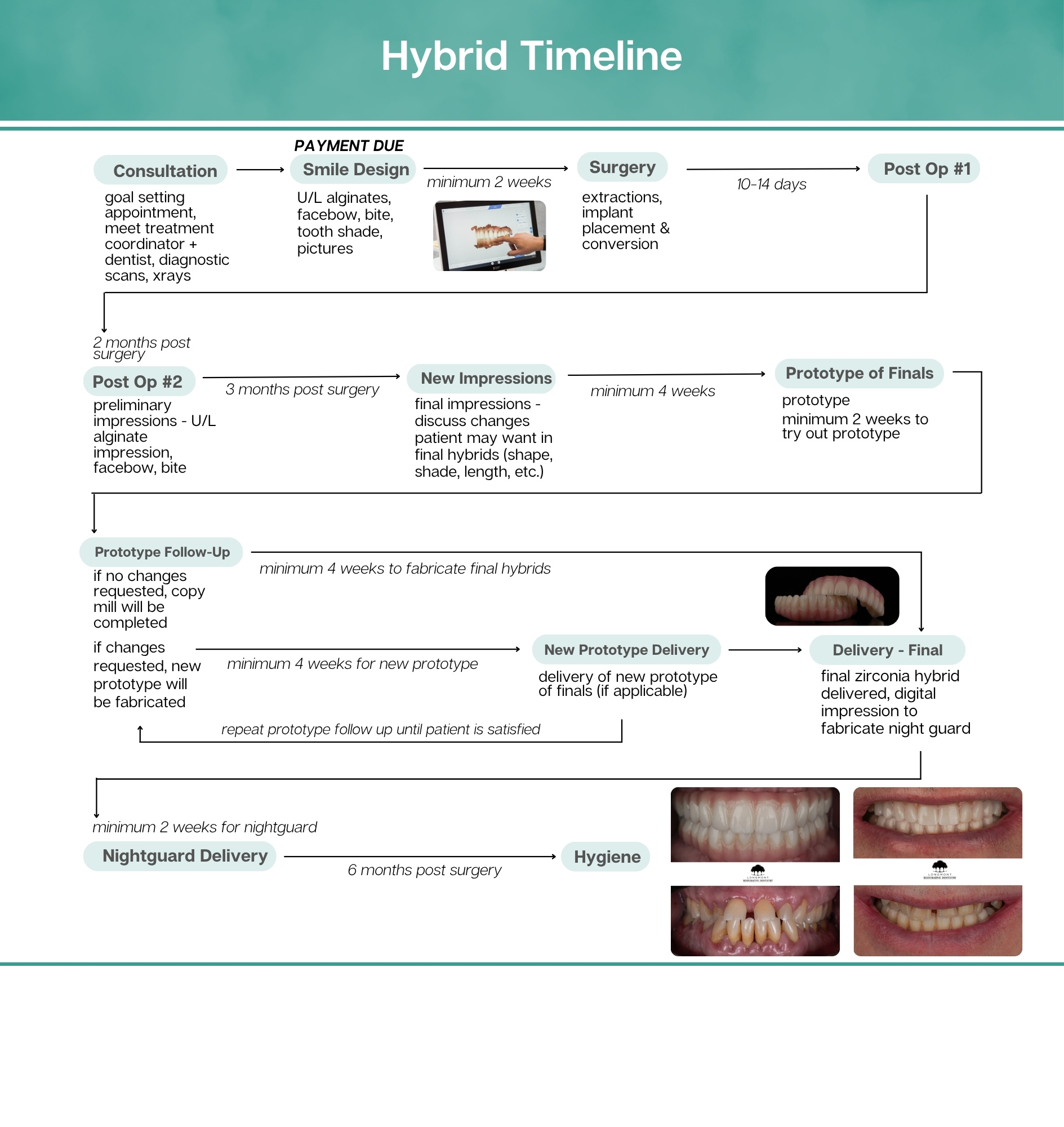 Hybrid implant-supported denture treatment timeline