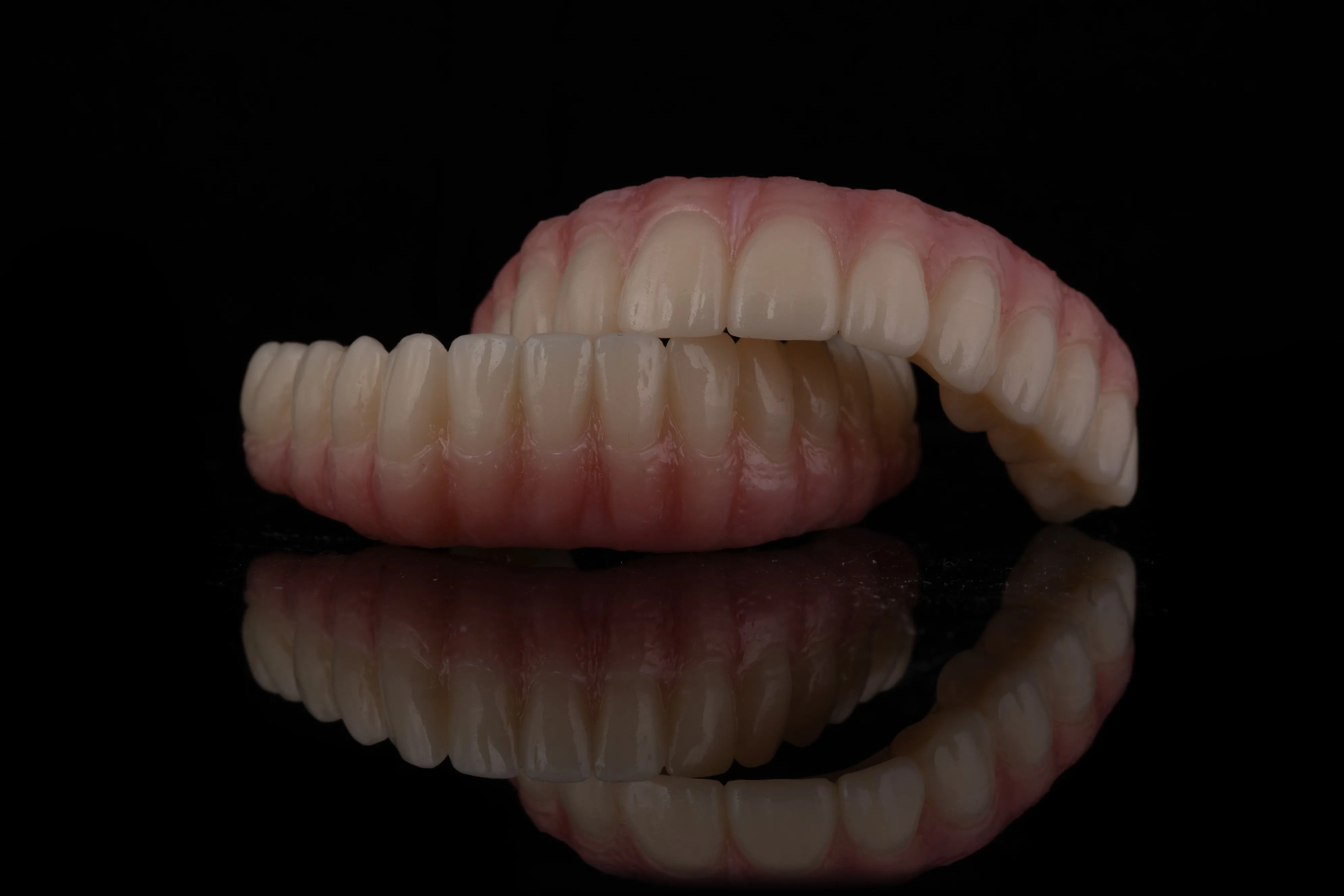 Custom denture prosthetic crafted in our in-house lab