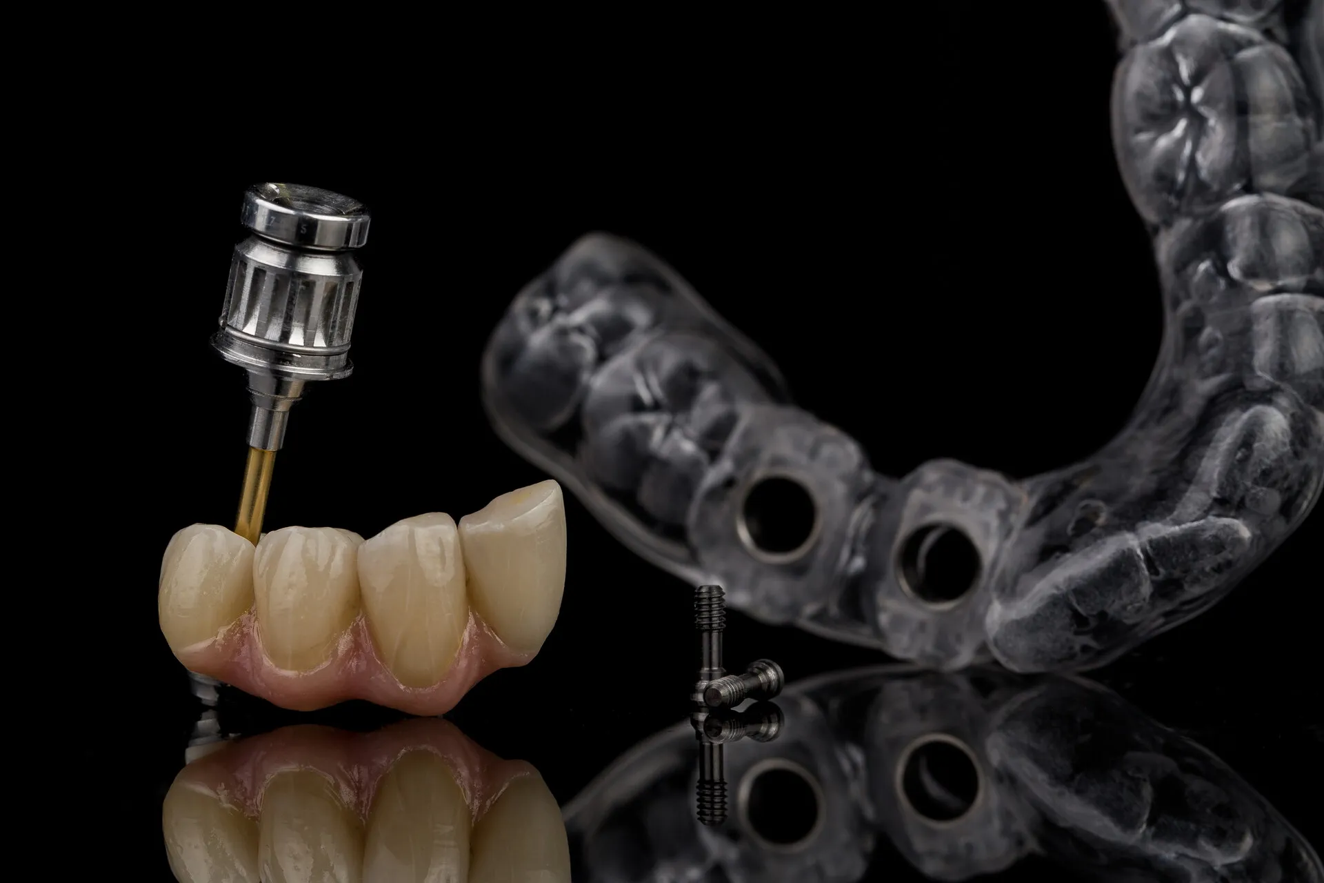 Implant bridge with surgical guide