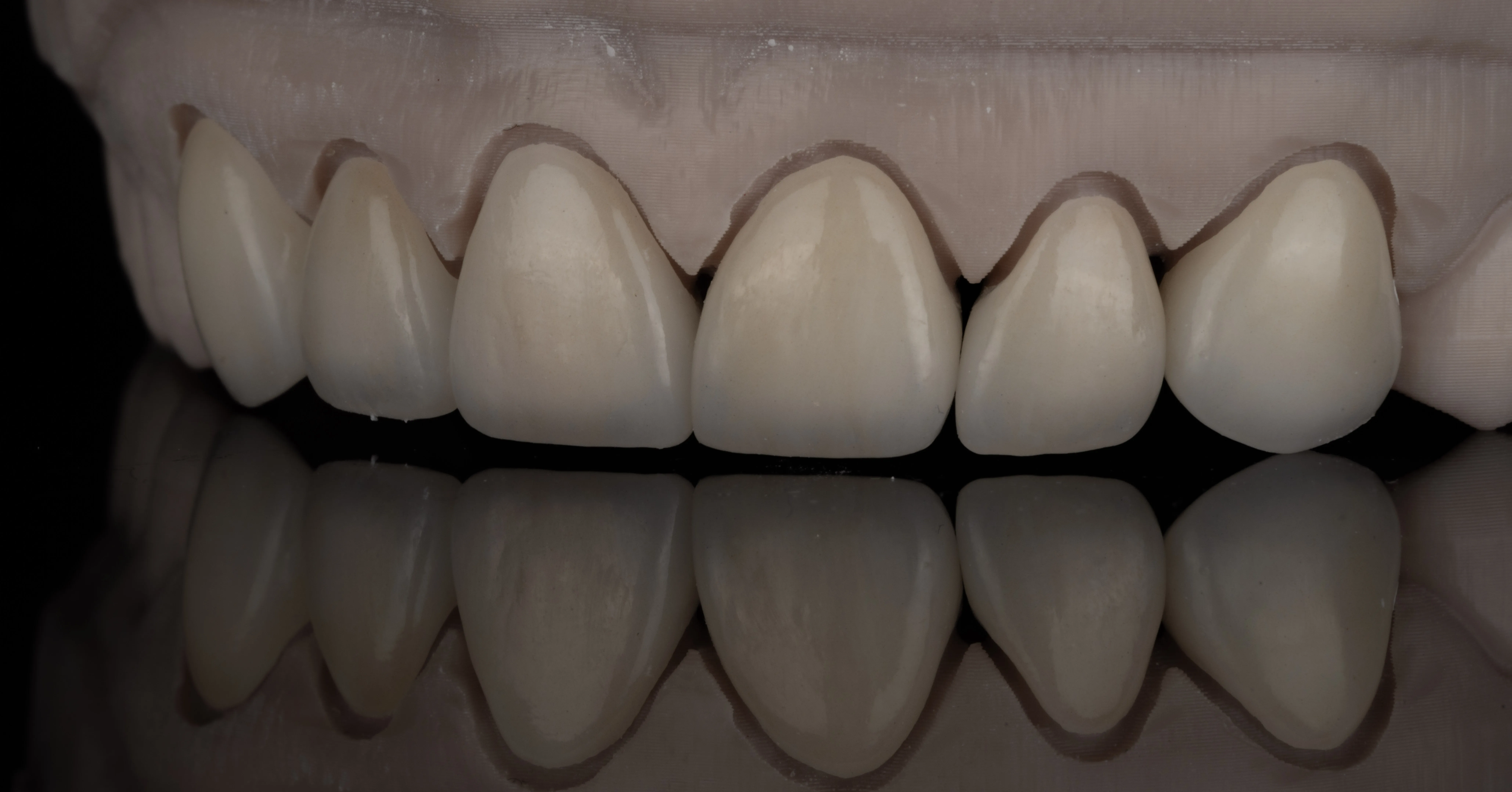 Dental implant components and prosthetics