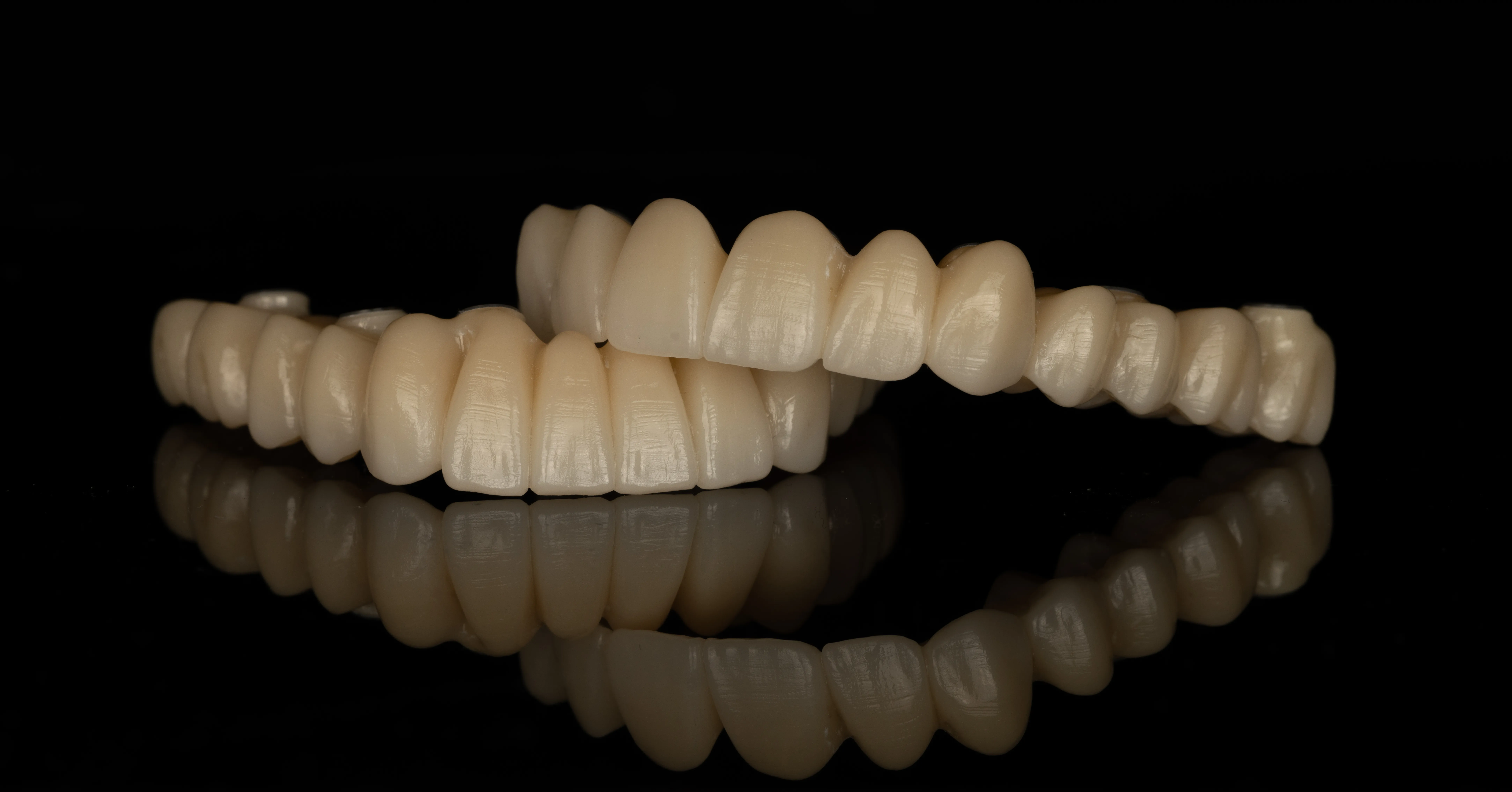 FP1 implant-supported denture — natural teeth appearance